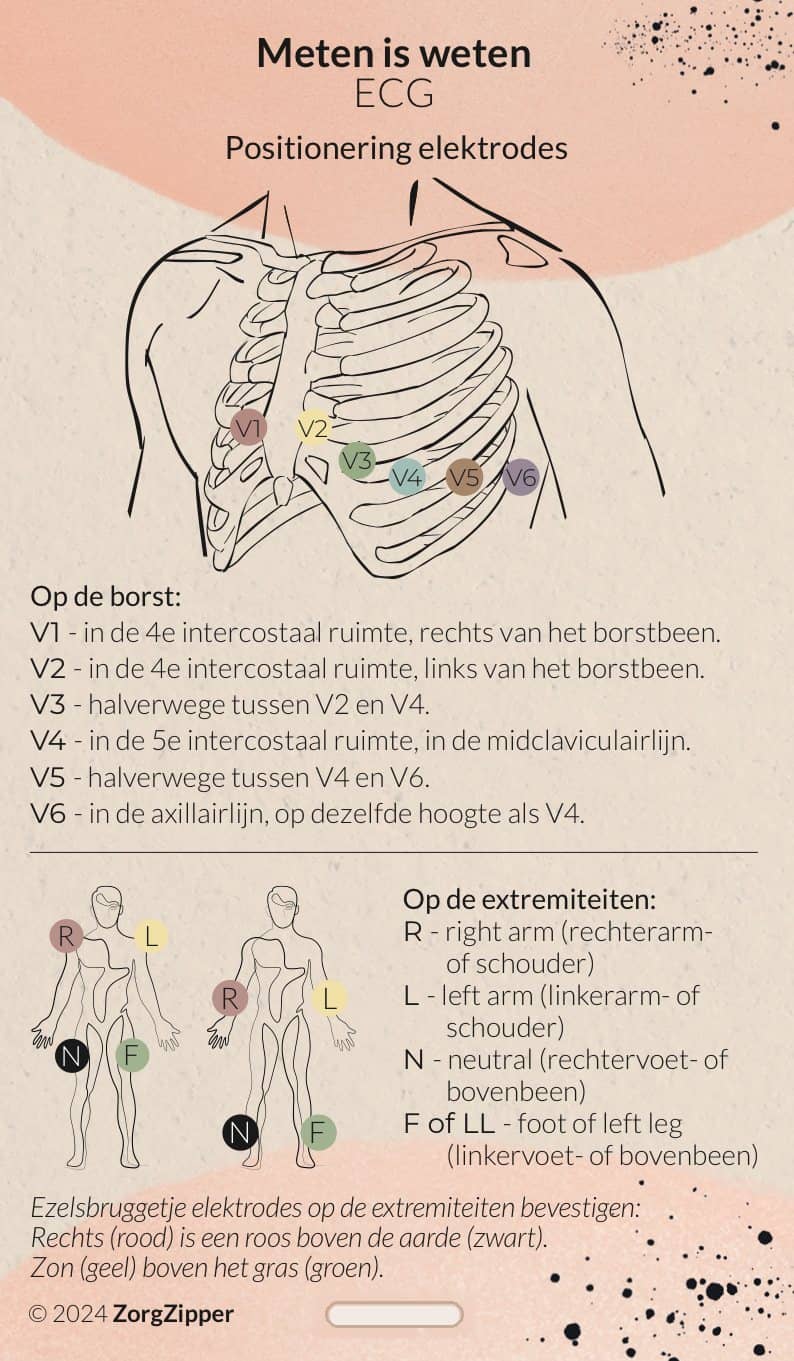 Meten is weten: ECG, voorkant