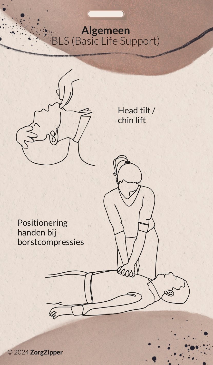 Achterkant van de kaart Algemeen: Basic Life Support